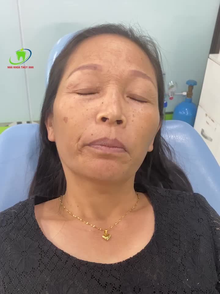 ĐAU HÀM, ĐAU ĐẦU, MẤT KHẢ NĂNG ĂN NHAI TRONG 2 NĂM, CÔ KHÁCH HÀNG BẮT XE ĐÒ 200KM TỚI THUỲ ANH CHỮA TRỊ
